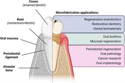 Microfabrication approaches for oral research and clinical dentistry
